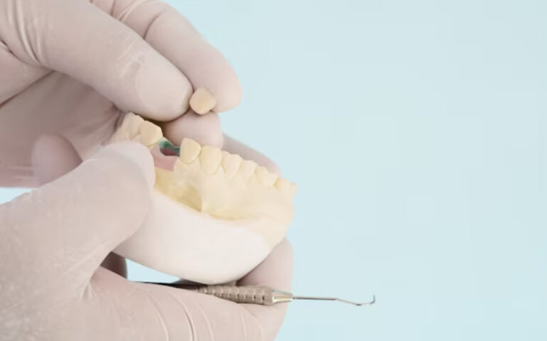 Painless-Wisdom-Tooth-Removal-Gandhinagar