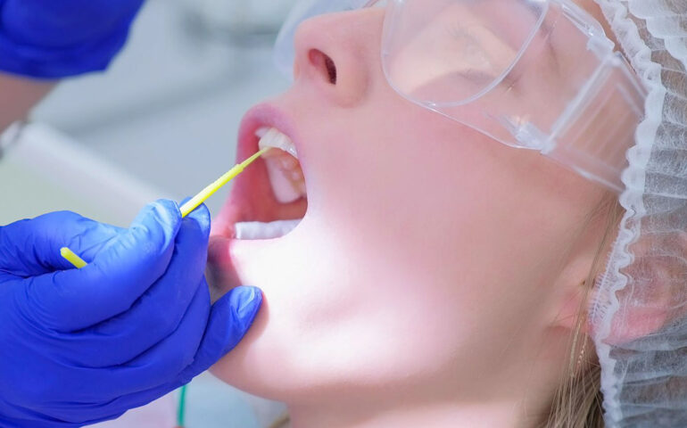 Fluoride Therapy