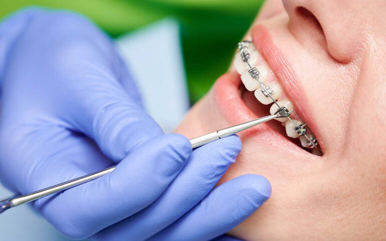 Orthodontics