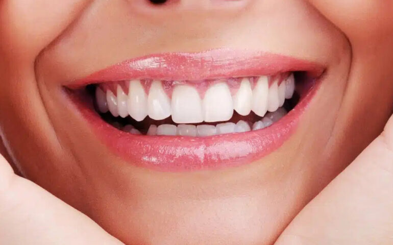 Smile Analysis and Smile Design