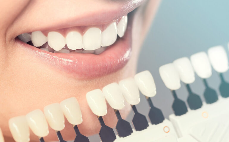 Cosmetic Dentistry